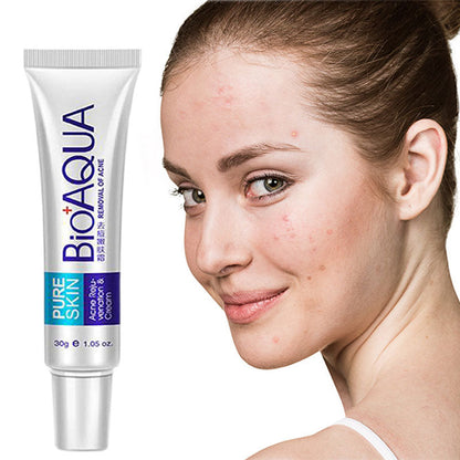 CREMA ANTI ACNE - BIOAQUA