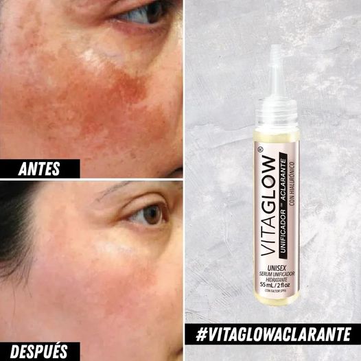 DESPIGMENTANTE - ACLARANTE  VITAGLOW