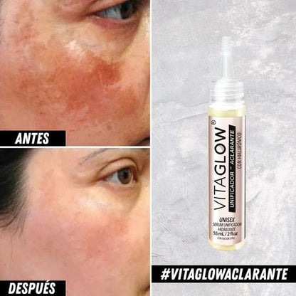 DESPIGMENTANTE - ACLARANTE  VITAGLOW
