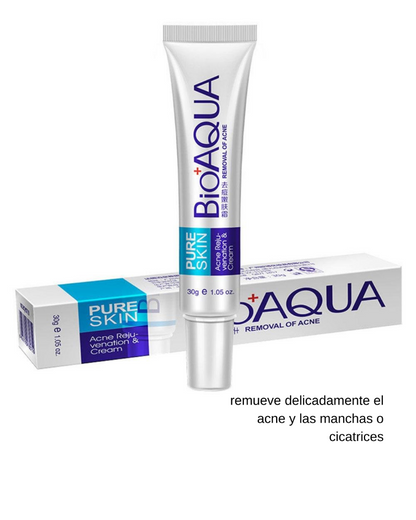 Kit Anti Acné Y Cicatrices Control De Grasa - BIOAQUA