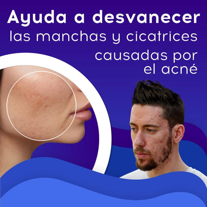 CREMA ANTI ACNE - BIOAQUA