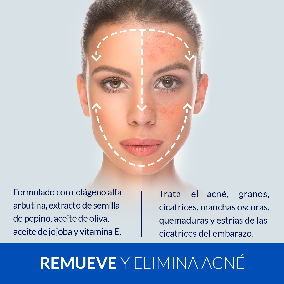 TONICO ANTI-ACNE  AFRODITA