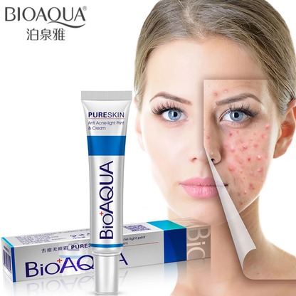 CREMA ANTI ACNE - BIOAQUA
