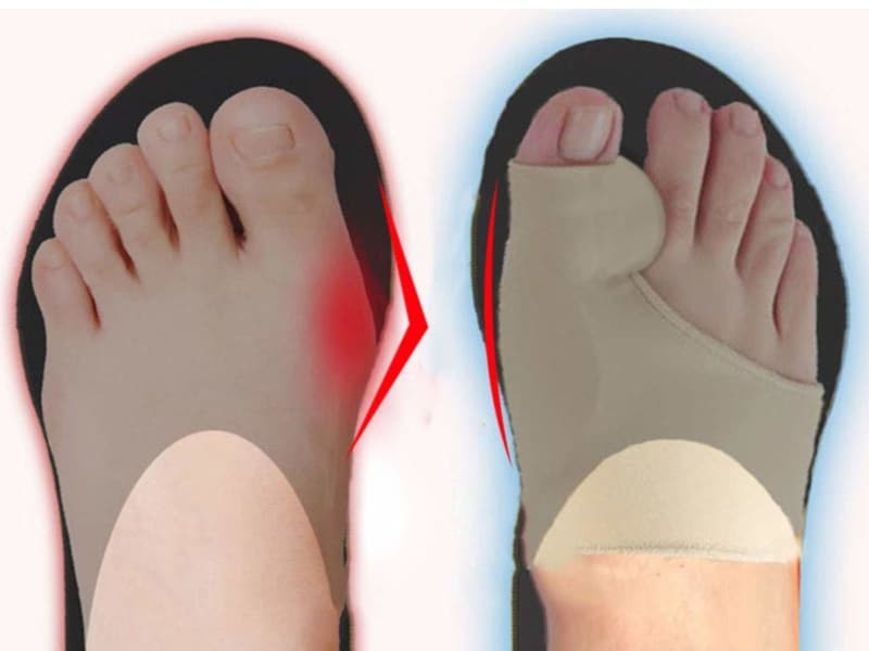 CORRECTOR DE JUANETES X 2 UNIDADES